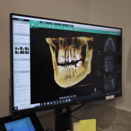 Digital X-ray on screen