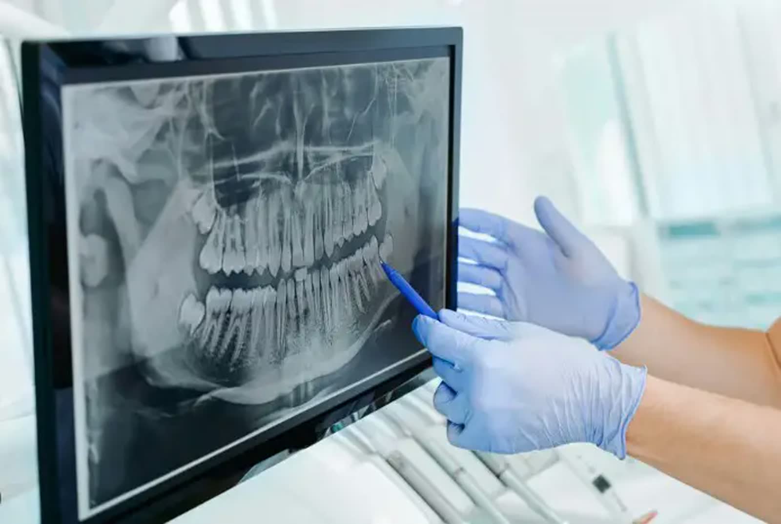 X-Rays – Should You Be Scared?